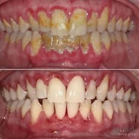 مرحبا محتاج تنظيف اسنان مجاني بشرط. يصور اسنانه ويدزهم يلا اشتغلهم اله...