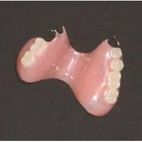 جذور تالفة • قلع سن • علاج مجاني