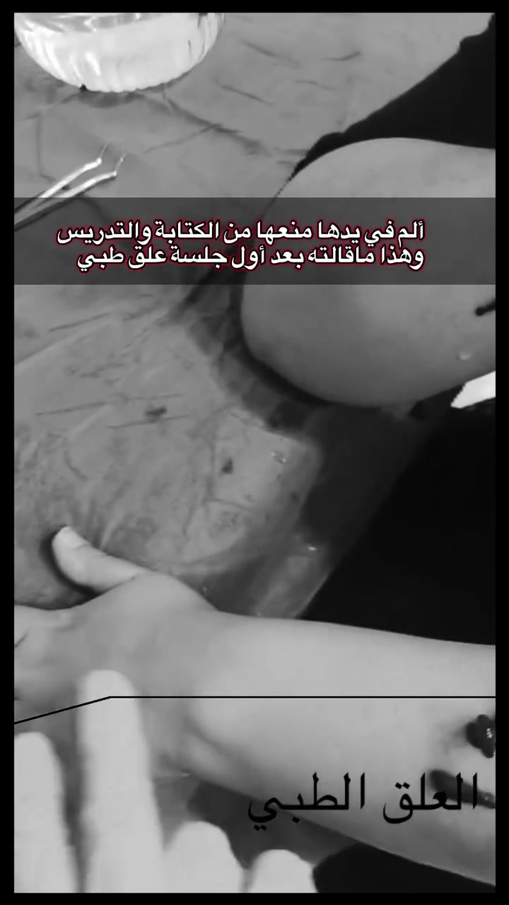 🚨معلمة كانت تعجز حتى عن الكتابة على السبورة… 
وهذا ما قالته بعد أول جلسة

وتين العافية
للطب التكميلي الشمولي

💥 الحجامة بأنواعها
💥 العلاج بوخز الإبر الصينية
💥 العلاج بدودة العلق
💥 العلاج بلسع النحل
💥 العلاج بالتغذية
💥 التأهيل الحركي

📍 العنوان:
قضاء خانقين
حي المعلمين
قرب جامع كافية

خبيرة الطب التكميلي الشمولي
خريجة المعهد الكندي الدولي
خبيرة في المكملات الغذائية

📱 للتواصل عبر واتساب:
***********

#عرق_النسا #الانزلاق_الغضروفي #آلام_أسفل_الظهر #دودة_العلق_الطبية #الطب_التكميلي #وتين_العافية #العلاج_الطبيعي
