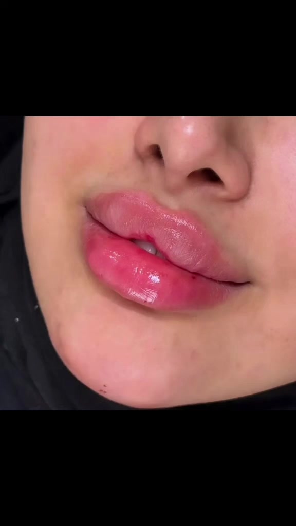 فلر فرنسي 1 سي
💋 عيادة هيلدا لطب الأسنان والتجميل 💋


**إذا كنت صاحب هذا الإعلان وتريد حذفه لأي سبب، رجاءا أرسل رسالة إلى الدعم الفني**