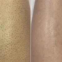 كوزمو لوشن • يوريا ١٠% • أصلي دبي