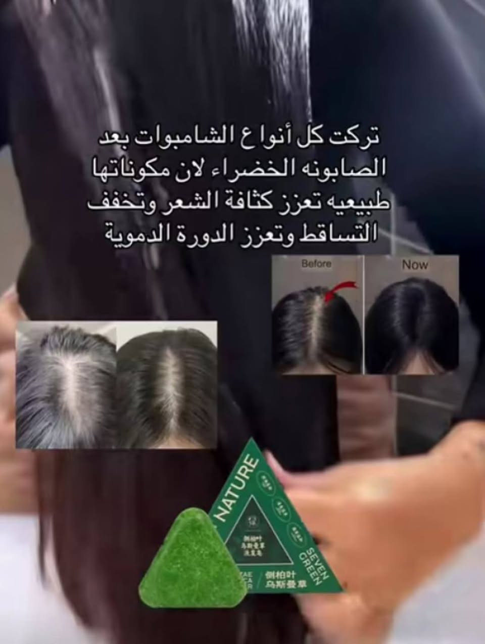 منتج صابونه سفن جرين الأصلي بالباركود🇨🇳✅
هتاخد دسته سعر خاص 
لو كميات مفاجاه
متاح توصيل محفظات 
فوائد 👇🏻
تمتاز الصابونة بقدرتها على تنظيف فروة الرأس بلطف، مما يساعد على إزالة الشوائب والزيوت الزائدة دون أن تسبب جفافًا، لتتركي شعرك ناعمًا، لامعًا، وصحي المظهر. المميزات الرئيسية: تحتوي على مستخلصات الأعشاب الصينية المعروفة بفوائدها لفروة الرأس. تدعم تقليل تساقط الشعر وتعزز من قوته وكثافته

متوفر توصيل كوت ولكافه المحافظات 💜♥️🫂


**إذا كنت صاحب هذا الإعلان وتريد حذفه لأي سبب، رجاءا أرسل رسالة إلى الدعم الفني**