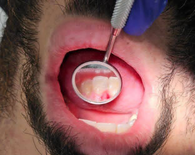 اي احد عنده اطفال جوة 14 سنة و يحتاجون حشوات اسنان او جلسات فلورايد  او قلع مجانا يراسلني خاص او واتس اب ***********
