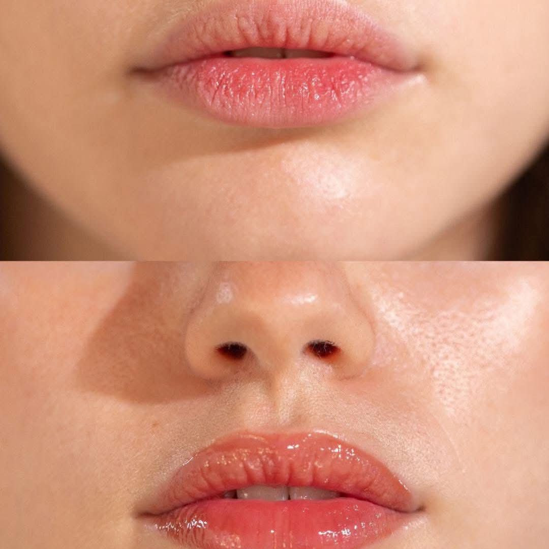 Pov: الماسك الي حينقّذ شفايفك ￼

من التقشير والجفاف والسواد 🍓🪄

ماسك الشفاه الليلي من لانيج الكورية✨
ترطيب عميق برائحة الفراولة مثالي للعناية بالشفاه ، يزيل الجلد الميت بلطف وغنيّ بفيتامين سي ومضادات الأكسدة فيساعد على التفتيح والتوريد💕

#تسليم_فوري 📦
📌متوفر


**إذا كنت صاحب هذا الإعلان وتريد حذفه لأي سبب، رجاءا أرسل رسالة إلى الدعم الفني**