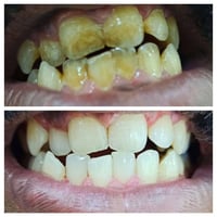 عيادة د. احمد رشيد لطب وجراحة الفم والأسنان 🦷✨ حيث تلتقي الخبرة الطبية...