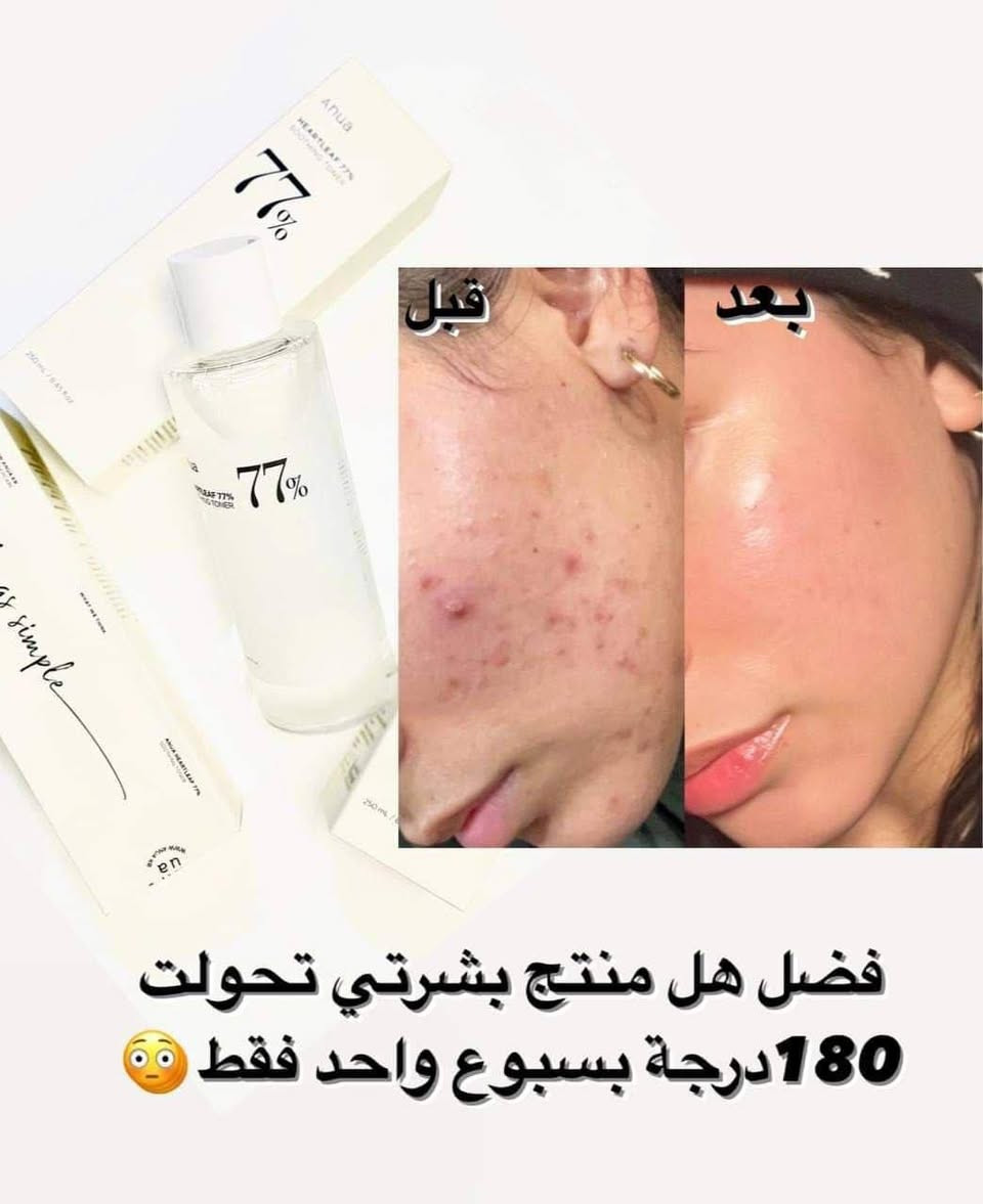غسول انوا البراند الاكثر
شهرة الزيتي الكوري 🇰🇷💯
💎Anua cleansing oil  

مع احترامي لباقي الغسولات 
لكن ماشفت غسول ينظف ويزيل المكياج ويقلص المسام يرجع البسرة نفش بسرة الطفل
ويعالج الحبوب مثل هذا الغسول الزيتي من أنوا
غسول رائع  للتحكم في المسام هو منتج لطيف للتنظيف العميق يمكن استخدامه بأمان حتى على البشرة المعرضة لحب الشباب 🤍🩵
يزيل هذا المنظف الزيتي  المكياج بشكل فعال  ويذيب الزهم بقوة 
تنظيف قوي ويعطي لمسة نهائية منعشة 
تظهر نتائج الاختبار أن الرؤوس السوداء انخفضت بنسبة 18% والرؤوس البيضاء بنسبة 20% وانخفض حب الشباب بنسبة 83% وتم التحقق من التأثير

طريقة الاستعمال :
1. ضعي كمية مناسبة من الزيت على الأيدي الجافة 
2. ضعيه على كامل الوجه وهو جاف 
3. اشطفيه بالكامل بالماء 
الحجم: 200ml
#الاصلي المنشأ كوريا 🇰🇷💯
🚘#يوجد #خدمة #توصيل #لجميع #محافظات #العراق 🚘


**إذا كنت صاحب هذا الإعلان وتريد حذفه لأي سبب، رجاءا أرسل رسالة إلى الدعم الفني**