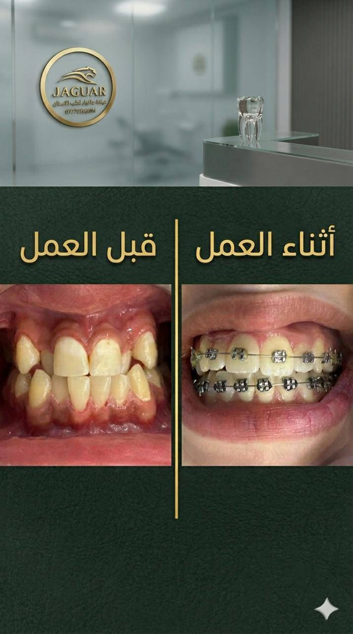 عياده جاكوار للاسنان
عنوانه الحارثيه خلف مستشفى الاميرات 
(قلع - حشوات - تنظيف - تقويم - زراعه ـ تبييض ـ ابتسامه المشاهير ـ جسور ثابته ـ ) 
للاستفسار اتواصلوا واتساب 
***********
