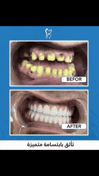 استثمارك في صحة أسنانك هو استثمار في ثقتك بنفسك  [أبتسامة جميلة _ ثقة ...