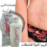 تشققات الحمل • OSCAR • كولاجين