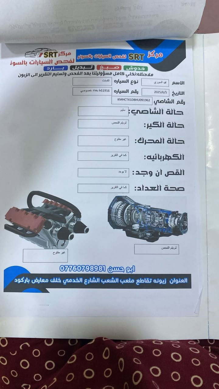 هونداي اكسنت خليجي

موديل2017

ماشية 120الف 

فول مواصفات 

مكفولة من الضربةومن الصبغ

بيهة طخات موضحة بلصور والسونر

تخم تاير جديد 

كامرة امامي خلفي 

اشاير بلمري  

رايدهة ب120 وبيهة مجال بسيط 

سيارة خير من الله

رقم *********** رقم بي وتساب مكان السيارة الدورة
