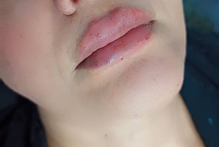 مستمرة عروض الفرررر


**إذا كنت صاحب هذا الإعلان وتريد حذفه لأي سبب، رجاءا أرسل رسالة إلى الدعم الفني**