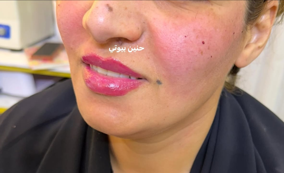حنين بيوتي 🍒مصنع الحلويات 🍒


**إذا كنت صاحب هذا الإعلان وتريد حذفه لأي سبب، رجاءا أرسل رسالة إلى الدعم الفني**