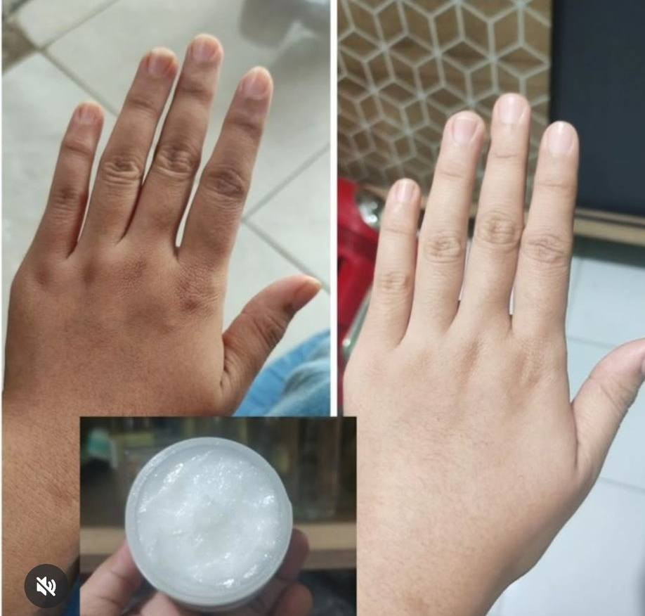 كريم ملكه تبيض نضاره للبشره


**إذا كنت صاحب هذا الإعلان وتريد حذفه لأي سبب، رجاءا أرسل رسالة إلى الدعم الفني**