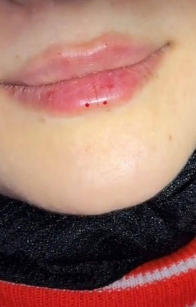 +964 788 968 7846
انواع الوشام ٢٥ الف فقط اما الشعر حسب لطول

بوتوكس وافلر شفة واابرا نظارة  ٦٠ الف فقط

فلر شفة ٣٥ فقط

النهروان خلف مطعم جواد شارع البزل مقابل مولدة ابو دراج ام علي زوجة ابو علي الاسمر
