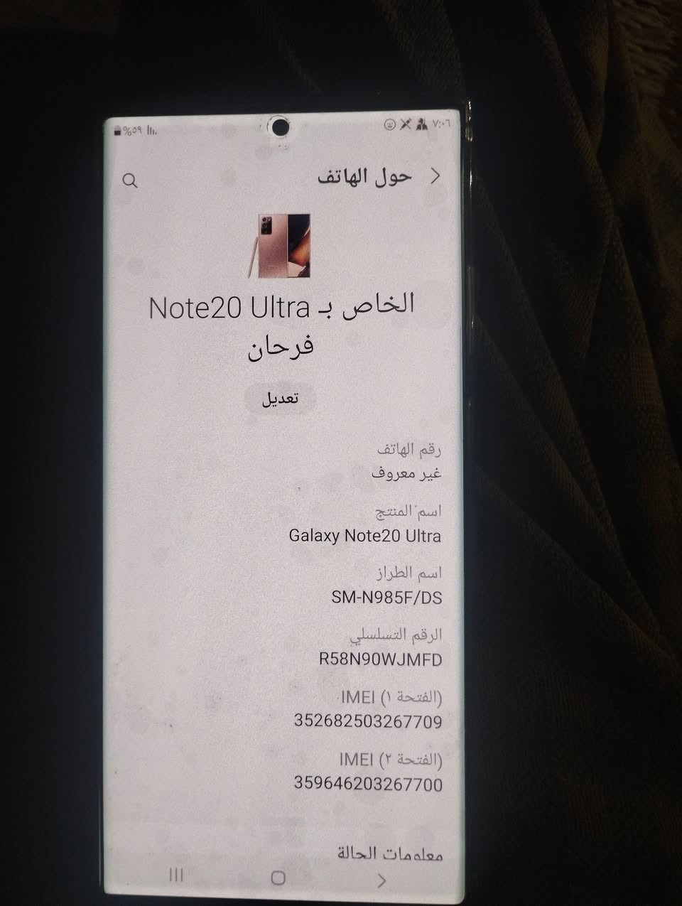 اسلام عليكم اس 20 الترا نضيف ستعمال ايام سعر 400 مكاني بغداد لبلديات متواجد على نت هذا رقمي ***********
