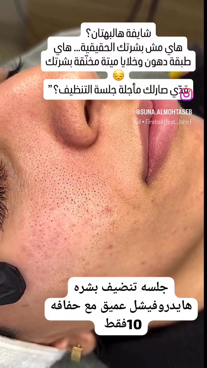 𝒲𝒶𝓇𝒹𝒶 𝐵𝑒𝒶𝓊𝓉𝓎 🎀 
🌷 ورده بيوتي 🌷 
الخطيب الزراعي شارع المولده الحمره شارع عيادات صحتي 
للحجز مراسله الصفحه الرئيسيه 
او مراسله الرقم واتساب ***********#لايكات #لايك #متابعه #عناية #بشرة #عناية_بالبشرة #اكسبلور  #بشره #حبوب #جميله #العراق #explore #skincaretips #skincare
