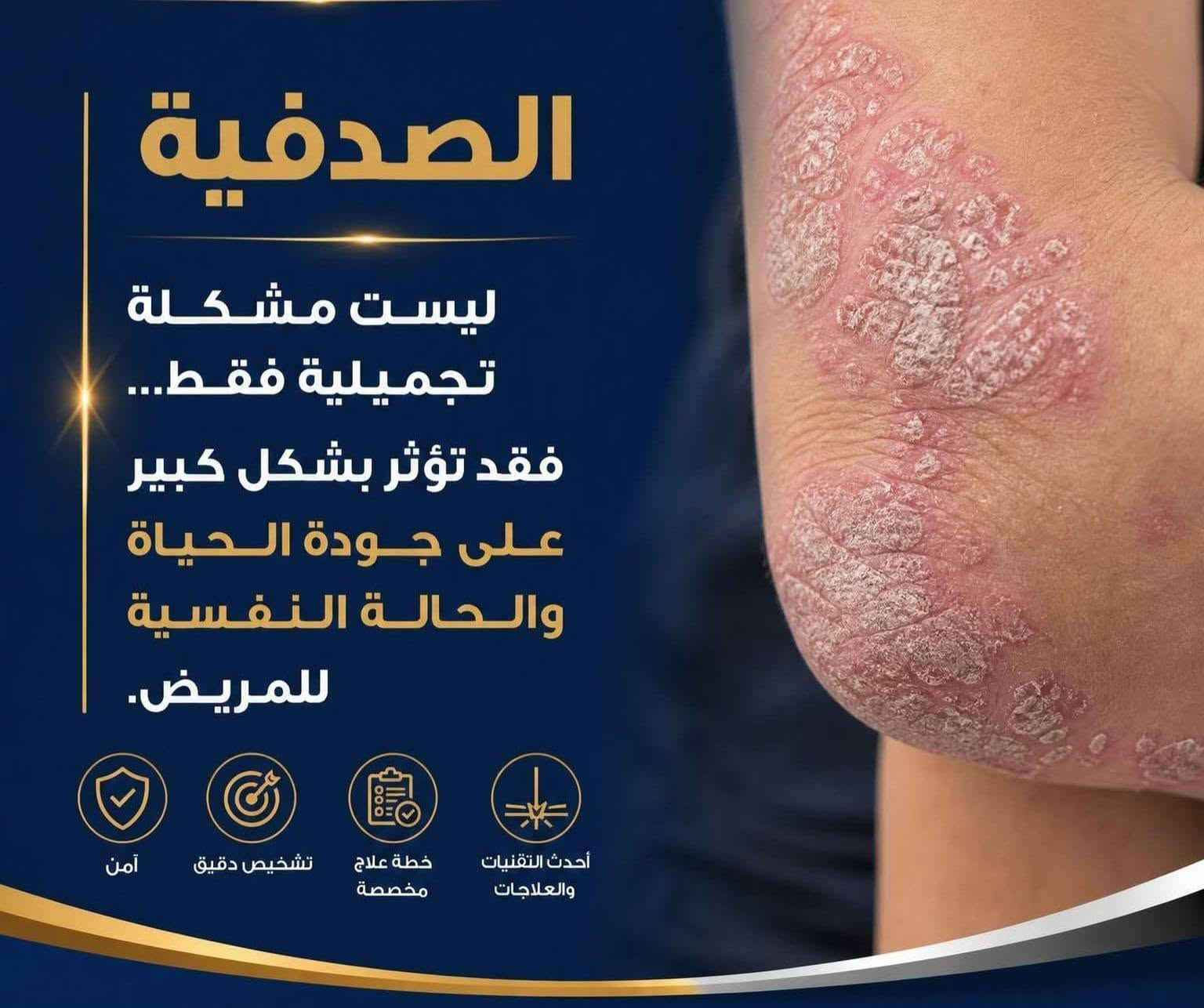 الدكتورة هبة اسامة عبدالغني اخصائيه الجلديه والتجميل والليزر تتواجد باجر عصراً الساعه4
#تتواجد_يوم_الاحد_الاربعاء
دكتوراه (بورد عراقي)
#الأمراض_الجلدية_التجميل_العلاج_بالليزر
زميلة الجمعية العراقية للأمراض الجلدية
بكالوريوس طب وجراحة عامة
زميلة المجلس العراقي للاختصاصات الطبية

M.B.CH.B.   F.I.B.M.S (D&V)
علاج الامراض الجلدية و الزهرية و حقن الفلر و البوتوكس و ازالة الشعر بالليزر -علاج الهالات السوداء و التقعر حول العين-علاج حب الشباب و اثاره-علاج الثالول و ازالة الزوائد اللحمية

للحجز و الاستفسار
***********
***********

العنوان
الحويجة _شارع الاطباء _مجمع الكندي الطبي
