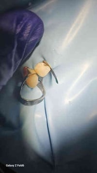 يتوفر  - قلع الأسنان والجذور  - تنظيف و تبييض الأسنان وازالة التكلسات ...