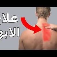 معالج الابهر كابتن أحمد ابو فلاح يعد العلاج الطبيعي من طرق التخلص من أ...