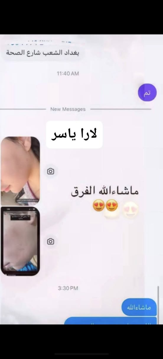 الحمد الله على نتائج كريم لارا ياسر
فديت كيكاتي احبكم 😘😘😘


**إذا كنت صاحب هذا الإعلان وتريد حذفه لأي سبب، رجاءا أرسل رسالة إلى الدعم الفني**