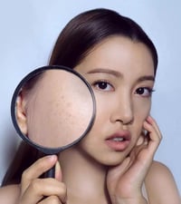 طين بركاني • تفتيح فوري • كوري أصلي