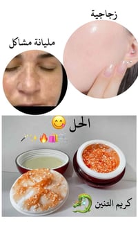 خلطة التنين • تبييض • تصبغات