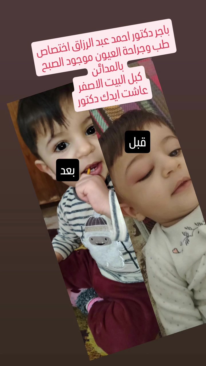 السلام عليكم
باجر دكتور احمد عبد الرزاق اختصاص طب وجراحة العيون موجود العصر الجمعه بالمدائن
كبل البيت الاصفر
أي استفسار هذا الرقم ***********بيه واتساب
*********** بيه واتساب
