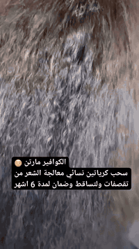 اجيتكم بعرض الكرياتين اسمع 👇👇😌😌😌
سحب كرياتين ومعالجة الشعر من التقصفات والتساقط 
تغير جذريي وبضمان ٦ اشهرر 
تدري كل هاذا العرض بشكد 
ب ٣٥ بسسس 
العرض لمدة سبوع وبسس ترا 😒
مو بس هيج تعالو نسائي هم نشتغل عيني وختصاص هم 😌😌
احجز قبل لا ينتهي 😌
الاستفسار ***********
