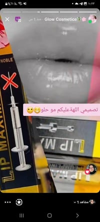 فيلر شفايف • حمر رباعية • بدون إبر