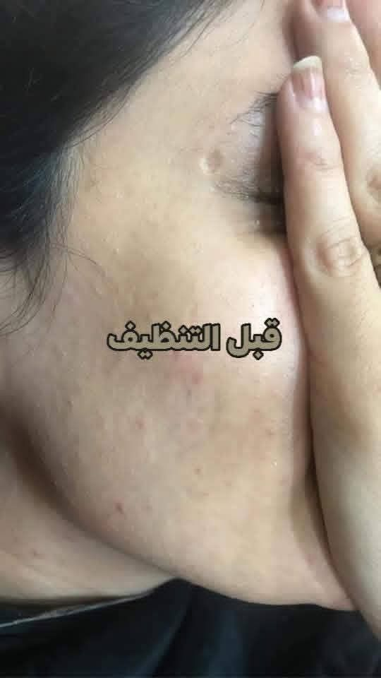 عروض وتخفيضات شهر رمضان المبارك 🌙🌙🌙صالون الريتاج  متواجدين طيلة شهر رمضان  من 10صباحا الى 12اليلا
صالون الريتاج 
حفافة وتنظيف بشرة وصبغ حاجب ب 10🤗
تاتو بلوك 15❤
تصحيصح حاجب ب 35😍
نانو فايبروز 30🤗
توريد شفة دائمي 15 تحديد 10❤
ضمان الشغل والمادة طول العمر🤗🤗
تسريح شعر قصير كارية 45 🫶
وسط 60♥
طويل 70🫶 صالون الريتاج 
اما لافريقي 85💕
صبغ شعر من 10الي 30
سحب بارد من 10الي 25
صالون الريتاج 
ميش شعر من 15الي 40
وشم من 5الي 35
عروس حنة وزفة 175مع هديه
صالون الريتاج 
تركيب رموش طرفية 15وكاملة 25
خطوبه ب 75
مدعوة ب 25
شيرة جسم 25
ثقب اذن نف  ب 5
الحجز قبل ساعةالعنوان لاسكندرية


**إذا كنت صاحب هذا الإعلان وتريد حذفه لأي سبب، رجاءا أرسل رسالة إلى الدعم الفني**