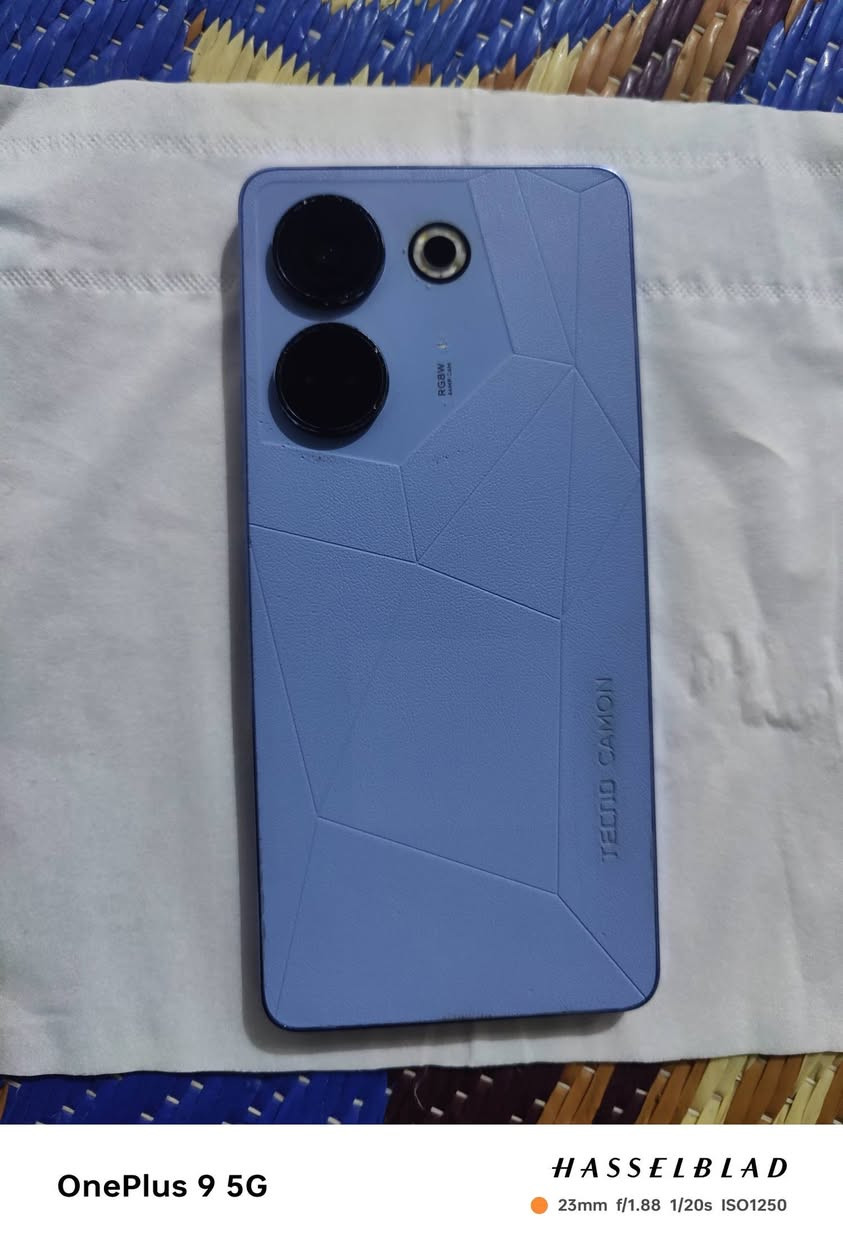 السلام عليكم 👋
موبايل تيكنو كامون 20 برو 
ذاكره 256/8
60 فريم بيجي ..
جهاز نظافته كدامك بي بس خط كلش صغير عله الساعه نفس مموضح بل فيديو وصوت بي خنه بس شغال
ملحقات: شاحن اصلي + كفر + لزكة شاشة . 
السعر : 135 الف وبي مجال 
متوفر توصيل 🚚


**إذا كنت صاحب هذا الإعلان وتريد حذفه لأي سبب، رجاءا أرسل رسالة إلى الدعم الفني**