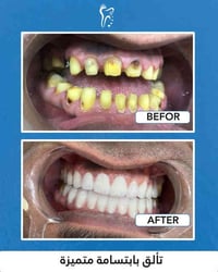 استثمارك في صحة أسنانك هو استثمار في ثقتك بنفسك  [أبتسامة جميلة _ ثقة ...