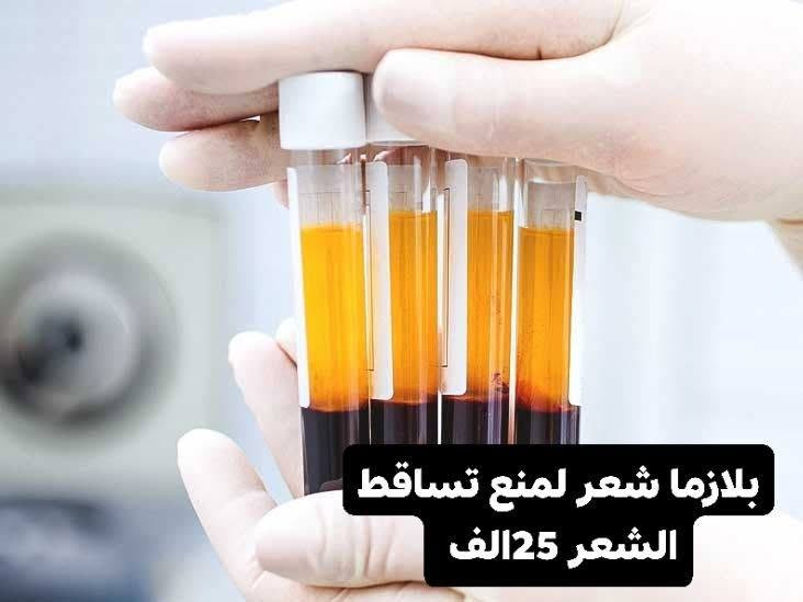 عروضنه متخلص يابنات ***********
50%تخفيضات

