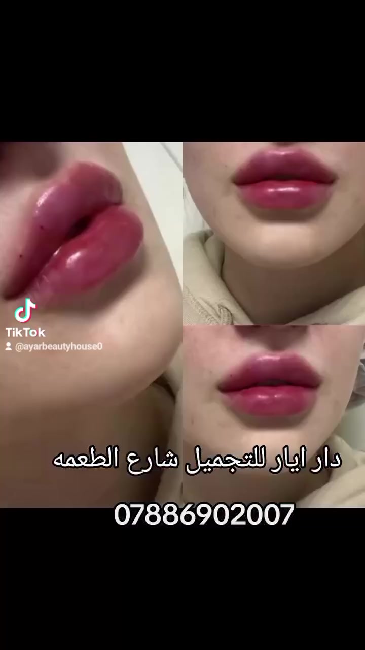 سعر سيسي كوري 45
سعر سيسي الامريكي 55
سعر سيسي سيسي الامريكي ماستر 75
سعر سيسي الايطالي 88
سعر سيسي فرنسي 95
سعر سيسي سويسري 150
مع كل طلب سيسي ابره نظارة وتبييض وتوريد وجنات ....شارع الطعمة الفلكه الثانيه دار ايار للتجميل 
***********
