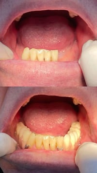 علاج مجاني • حشوات • النجف الاشرف