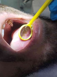 تنظيف اسنان • جامعة العين • غدا