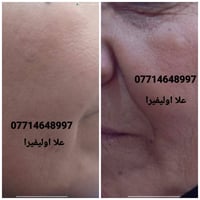 🙏انتبااااااااااه 🙏  الحجز فقط (وتساااااب ) علا اوليفيرا  0771464899777...