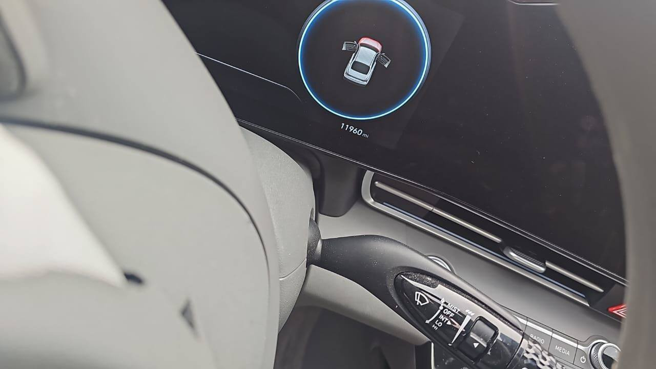 الانتره مديل 24 
السعر مصلح واصل مينا بدون كمرك 
السعر108 قفل قفل 
تررهم حره او شهداء

***********🟢واتساب
***********》🟢}{
كروب واتساب متوفر سيارات داخل الكروب متوفر سيارت
https://chat.whatsapp.com/DOvXOqYJsLL1PyHJkViq12
كروب  فيس شركه دايتونا لستيراد

https://www.facebook.com
كروب بيع مباشر
https://chat.whatsapp.com/E29EvOxmWAAIdz6uFt2cjI?mode=hqrt2
