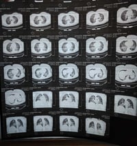 مجمع السفير الطبي • دكتورة راحيل • اختصاص صدرية