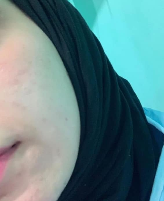 ‎خلطة رجالية /نسائيه

‎لتبيض الوجه 🔴علاج الكلف بالوجه حب الشباب واثاره 🔴التصبغات 
‎و عدم صفاء ونقاوة البشره 
‎الهالات السوداء

‎ خلطه تبيض الوجه وازالة الكلف والنمش المنتج
‎🌹خلطة  السحريه لتبيض الوجه  وبمفعول دائمي 😍
‎كل هذا بسر نجاح خلال اسبوع فقط لاغير لان سر جمالك هو اختصاصنا😍
‎المنتج مضمون ١٠٠٪


**إذا كنت صاحب هذا الإعلان وتريد حذفه لأي سبب، رجاءا أرسل رسالة إلى الدعم الفني**