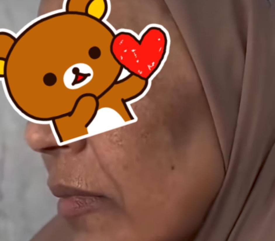 ***********سلام عليكم حبايب بعدكم ممجربين الخلطه العندي. والله العظيم عمره خساره الي ممجربه يشهد الله ورسوله شغله يجنن وعندي عنه تجارب خير من الله وحتى انطيت بيه ضمان استرجاع لانه متئكده منه ومن شغله ونتائجها تحلج كل مشاكل البشره السمرار التصبغ الكلف العنيد الجلح عدم النضاره مواده كله مختصه بهذا الشي والله خساره للماجربه هسه وعندي عنه تجارب خييير من الله الي يحب يدخل خاص وتدللون عيوني. 💓***********
