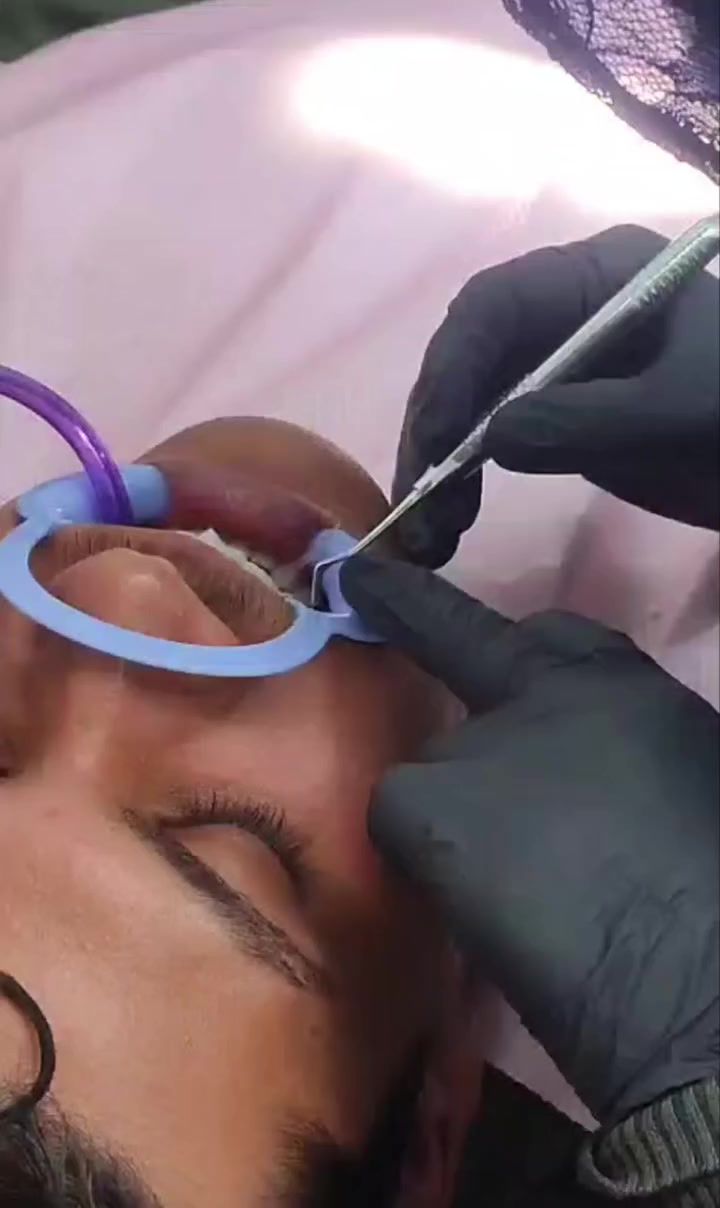 عروض ابتسامات العيد مستمرة 😍😍😍
داخل عيادات صحتي الطبية
الخطيب الزراعي _شارع ابي الأحرار 
للحجز و الأستفسار على الواتس اب 
***********
