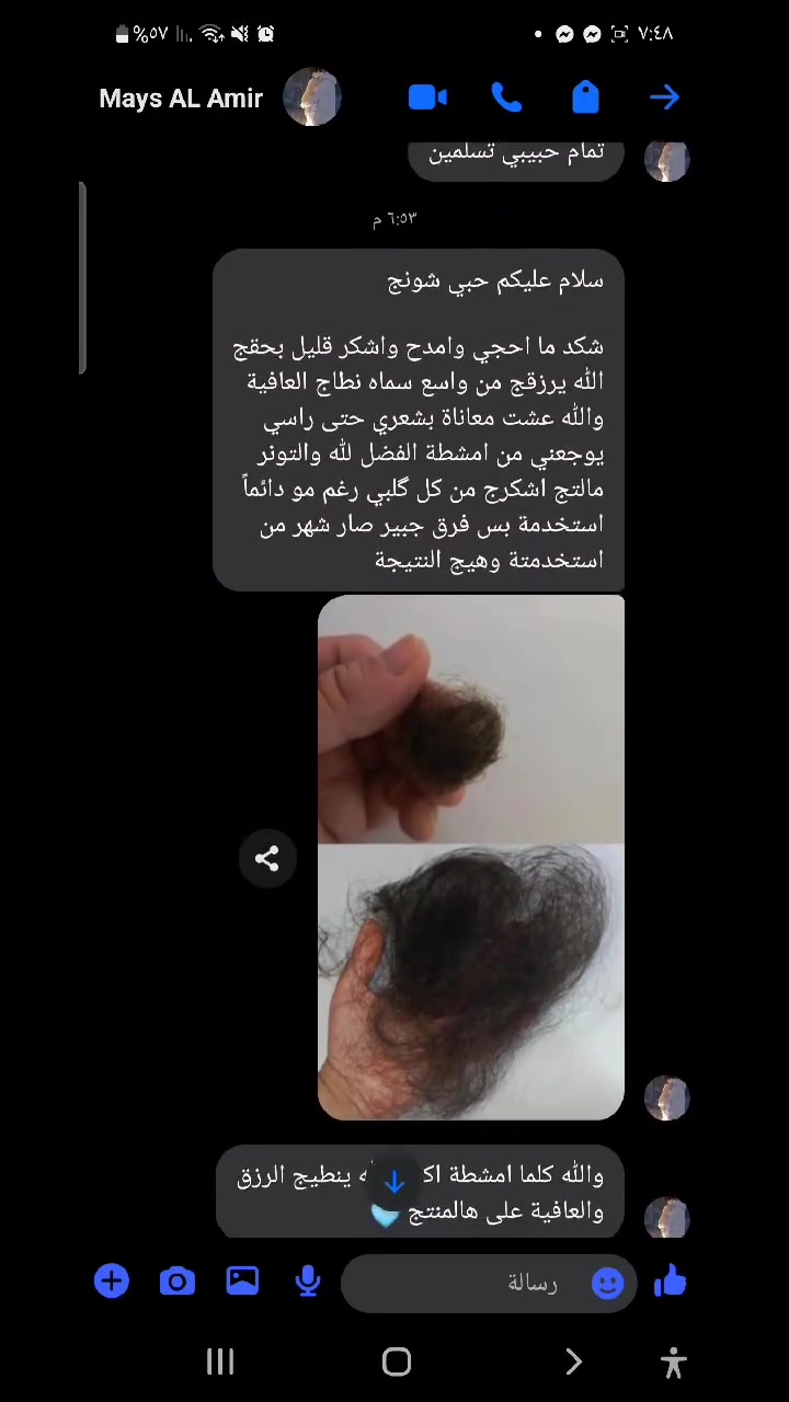 #بسم_الله🙏🏻
عروض العيددد 🫂😍😍
خلطه الشعر ب١٢ الف فقط بدال ١٥ والتوصيل مجاني 🚕🚕
اطلبي ٣ علب واحصلي ع خصم ب٣٠بدال ٤٥توصيل مجاني😎 
اطلبي ٤ علب واحصلي ع الخامسه مجانا وتوصيل مجاني🙉 
#ادللكم_بالعروض 🙊🙊


**إذا كنت صاحب هذا الإعلان وتريد حذفه لأي سبب، رجاءا أرسل رسالة إلى الدعم الفني**