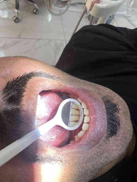 السلام عليكم 
الي محتاج ( تنظيف - قلع - حشوة ) وهذا جانب من شغلي 
العلاج مجاناً بالكامل 
الناصرية -شارع النيل
لتواصل / ***********
