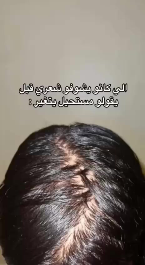 رجع توفر من جديد 😍👆🏻

🌿بكج  الزيت الافغاني ثلاثي الاصلي 💯🌿
الحل لجميع مشاكل الشعر
- تساقط الشعر
تثخين وتطويل الشعر
- الشعر الجاف
- فروة الرأس الدهنية
- تقصف أطراف الشعر
- التجعد
- الشعر الباهت
- تلف الشعر بسبب الحرارة
- تلف لون الشعر
وغيرها الكثير من مشاكل الشعر وحلها بمنتج واحد
🌿 الزيت الافغاني🌿
منتج مصنوع من مواد طبيعية 100% وبفعالية عالية
زيت الحشيش الافغاني  الاصلي 🌿🌿💚

سعر القطعة ٧ الاف 
سعر الزيت ١٠ الاف 

سعر البكج ٣ قطع ٢٠ الف


**إذا كنت صاحب هذا الإعلان وتريد حذفه لأي سبب، رجاءا أرسل رسالة إلى الدعم الفني**