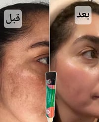 عصارة موفيت • تفتيح البشرة • تقشير