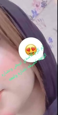 خلطة تبييض • خلطة توريد • كريم للبنات • كريم للوجه • علاج كلف • علاج ن...