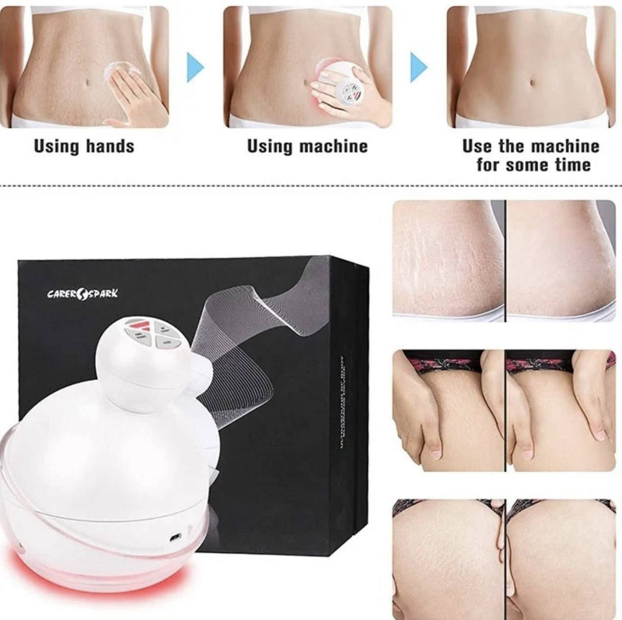 متاح 
جهاز تحفيز البشره 
متوفر قطعتين. القطعه على ١٥


**إذا كنت صاحب هذا الإعلان وتريد حذفه لأي سبب، رجاءا أرسل رسالة إلى الدعم الفني**