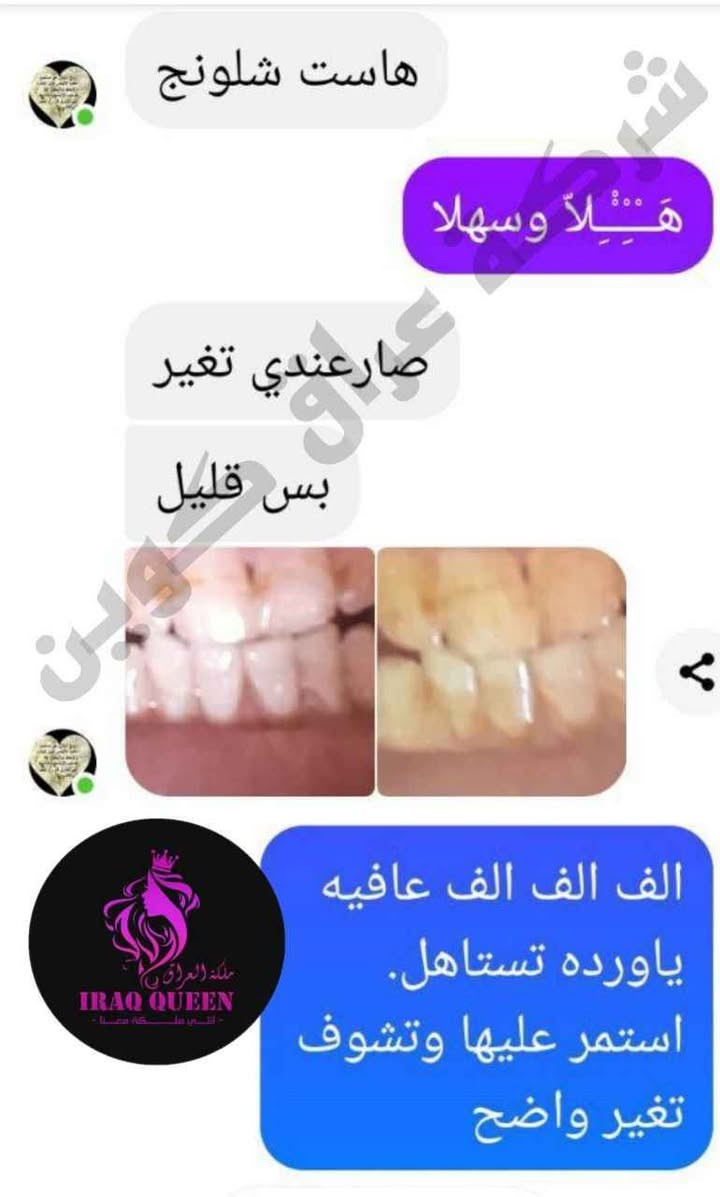❤️ 😍😍 Vaseina قطرات تبييض الاسنان من 😍😍 ❤️

يزيل التصبغات والاصفرار من الاسنان ✨👌
الي يعاني من صفار أسنان 😥 او بقع من كثرة التدخين او شرب الشاي والقهوة والمواد الصبغية ☕️🚬
وحاب يرجع اسنانه بيض استخدم منتج فازينا 👌👌 للتبييض الأسنان ومن اول استعمال 😍😍
أسرع مبيض اسنان على الإطلاق يزيل الاصفرار 🦷🔥 بغداد, العراق


**إذا كنت صاحب هذا الإعلان وتريد حذفه لأي سبب، رجاءا أرسل رسالة إلى الدعم الفني**
