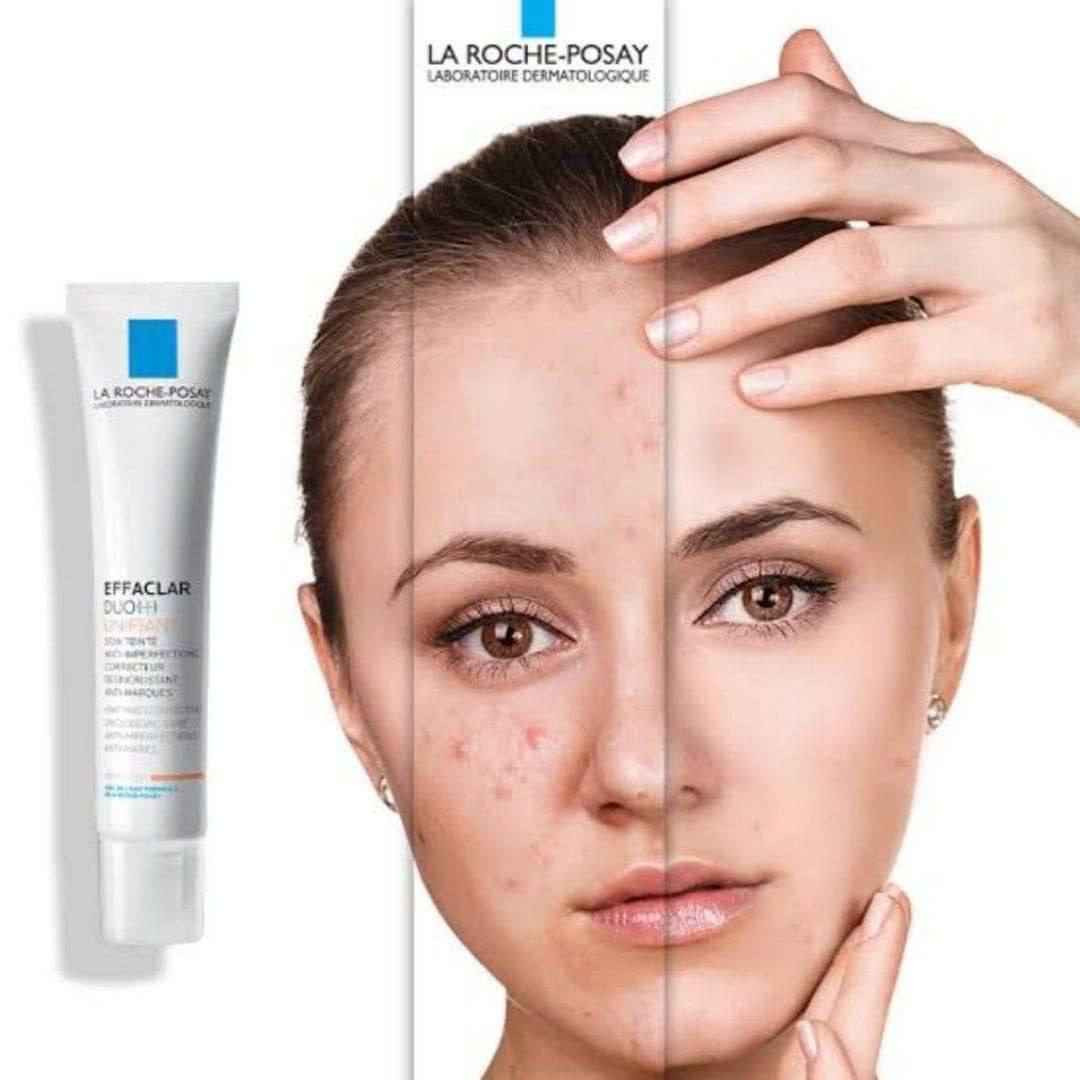 كريم لاروش الطبي مرطب ومصحح للبشره الأصلي الفرنسي 🇫🇷

✅الفوائد الرئيسية :
✔️- يقلل من ظهور الشوائب بشكل واضح وفي وقت قريب .
✔️- يقلل حجم المسام ويقضي على الرؤوس السوداء .
✔️- ينظم الافرازات الدهنيه ويتحكم بمظهر لمعان البشرة .
✔️- يوحد لون البشرة ويخفي الشوائب .
✔️- خالي من البارابين .
✔️- يناسب جميع انواع البشرة يحتوي على ٣ درجات🟤⚪🟡
- منتج طبي آمن 100%

الاصلي المنشأ فرنسا 🇫🇷 حلة, بابل


**إذا كنت صاحب هذا الإعلان وتريد حذفه لأي سبب، رجاءا أرسل رسالة إلى الدعم الفني**